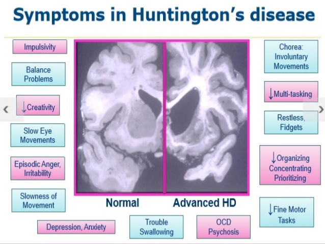 ias4sure.com - Huntington disease1